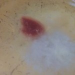 Miracolo eucaristico Polonia