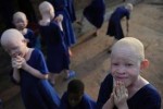 L’appello al Papa per gli albini del Congo