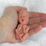 ABORTO/ La legge sul “battito del cuore” fa arrabbiare (molto) i nemici della vita