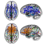 Gli studi sul cervello contestano l’ideologia di genere