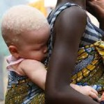 albini in Africa
