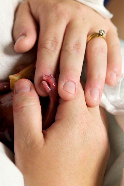 Il bambino che sta cambiando il dibattito sull’aborto