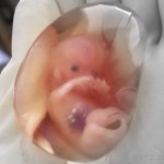 feto nel sacco amniotico