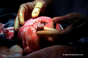 Sapete cos’è accaduto al bambino di questa famosissima foto?