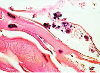 le fibre cardiache al microscopio